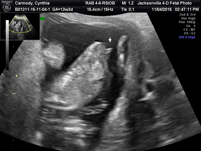Name:  BABY_20.JPG
Views: 285
Size:  171.7 KB