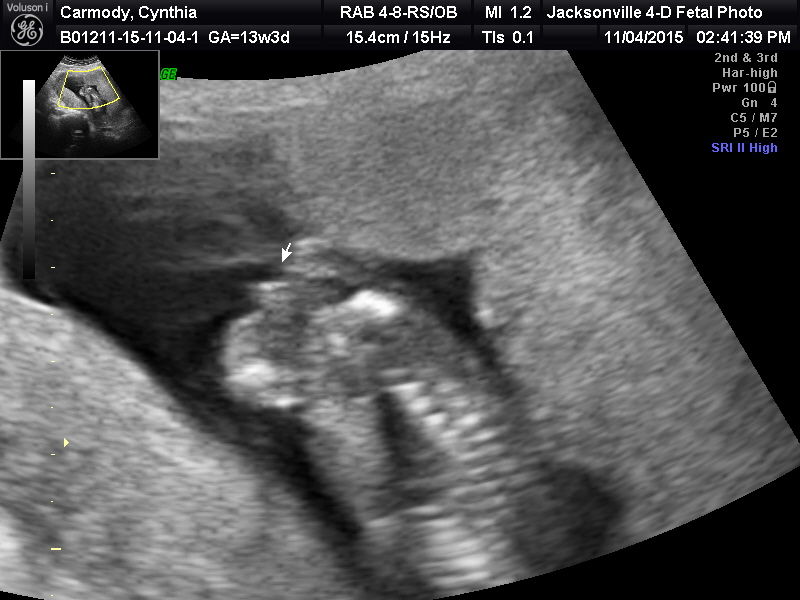 Name:  BABY_16.JPG
Views: 512
Size:  152.9 KB