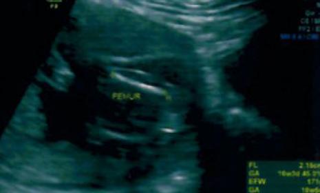 Name:  16W-Potty Femur.jpg
Views: 79
Size:  11.3 KB