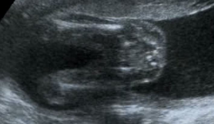 Name:  20w_pic1.JPG
Views: 120
Size:  35.1 KB