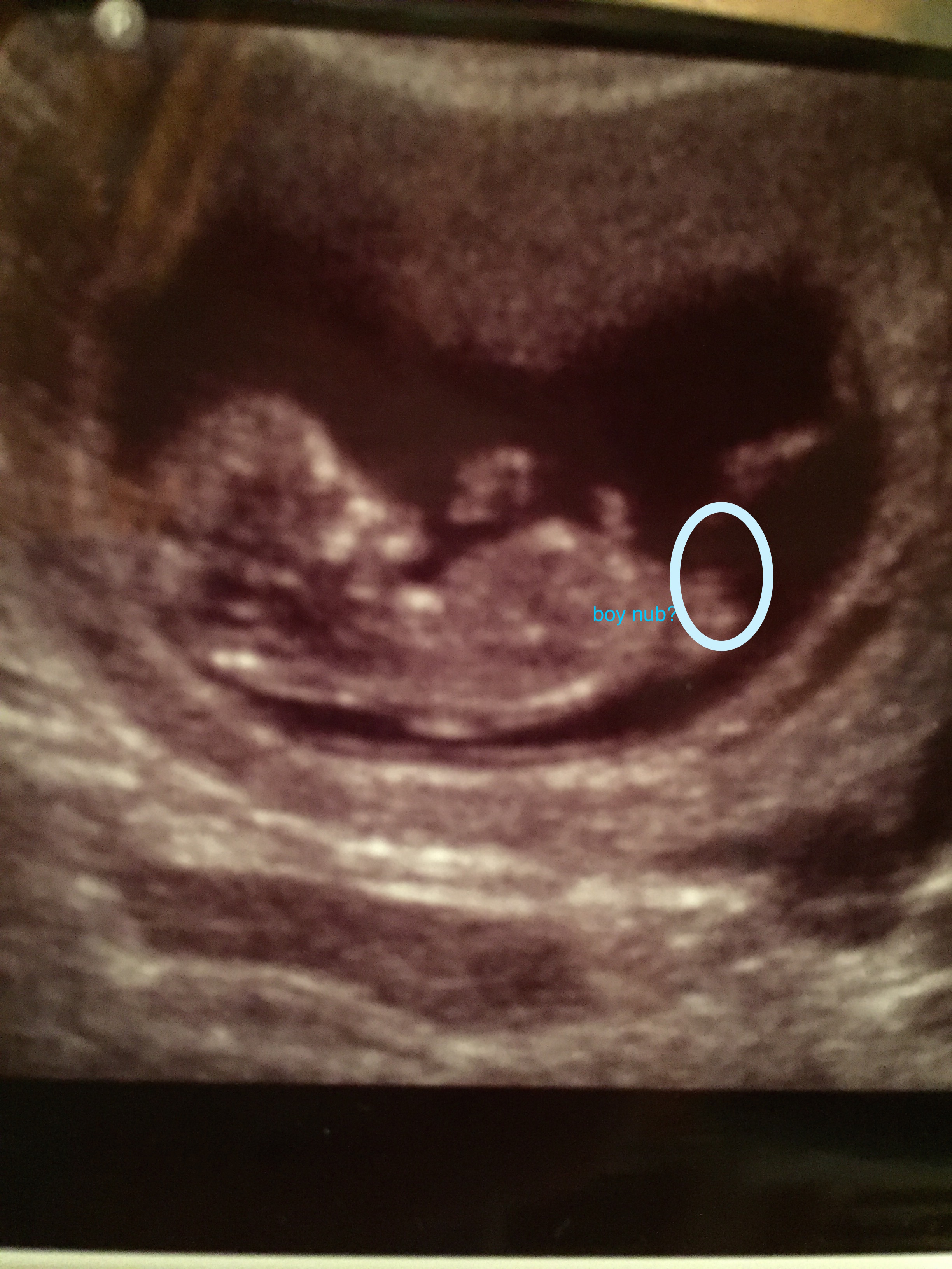 Name:  Baby2.JPG
Views: 864
Size:  1.44 MB