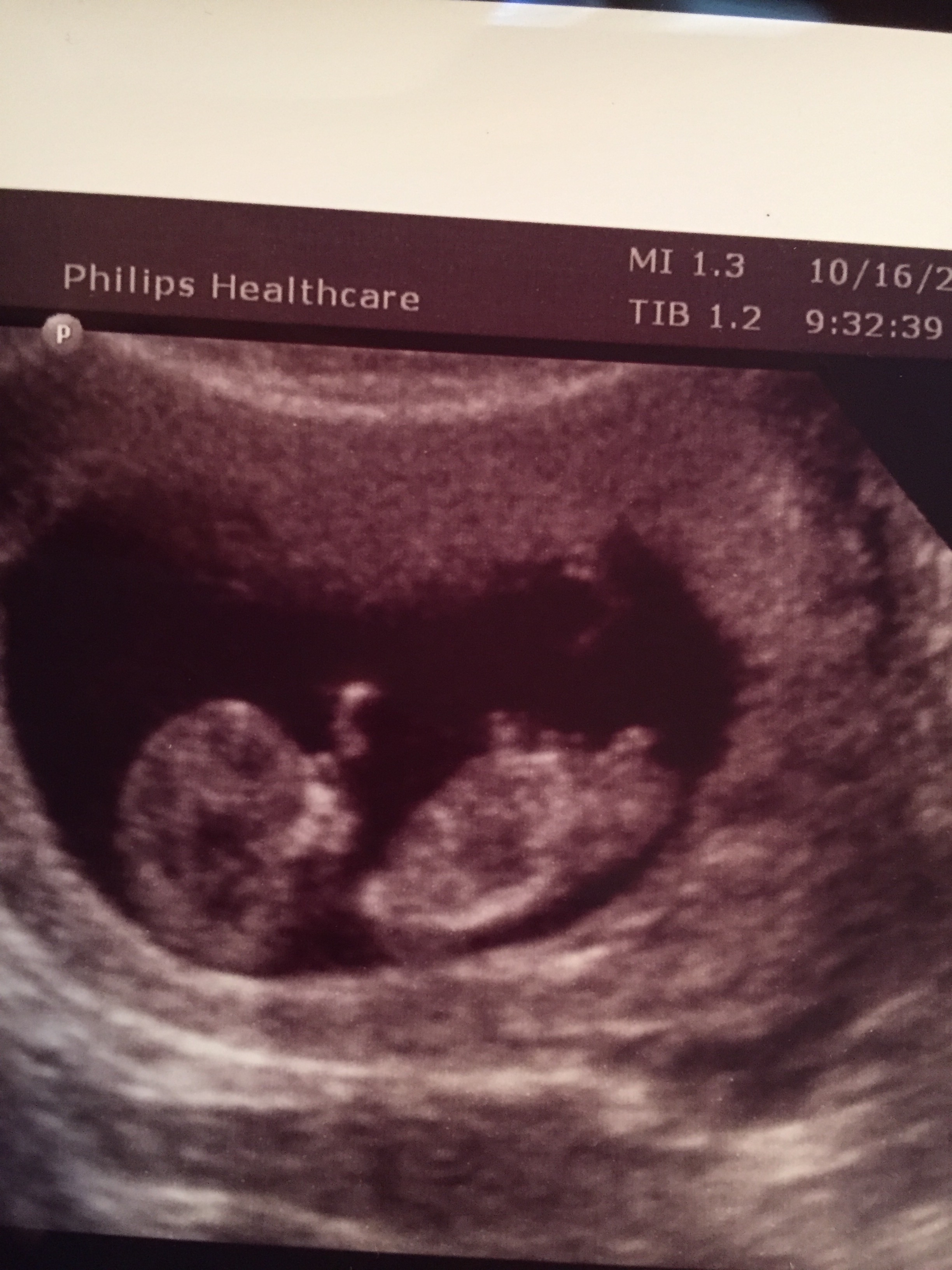 Name:  baby2.jpg
Views: 769
Size:  1.19 MB