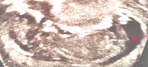 Name:  image.jpeg
Views: 357
Size:  156.4 KB