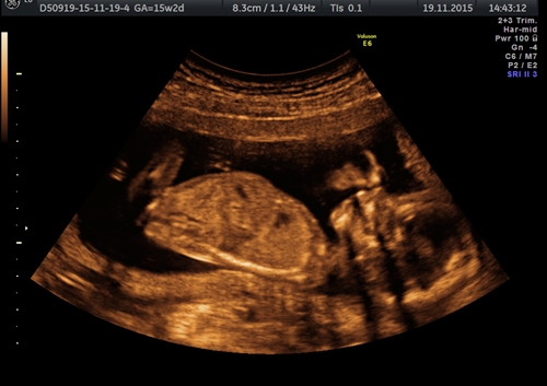 Name:  baby_12.jpg
Views: 140
Size:  96.7 KB