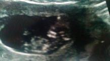 Name:  scan 11+2.jpg
Views: 69
Size:  4.9 KB