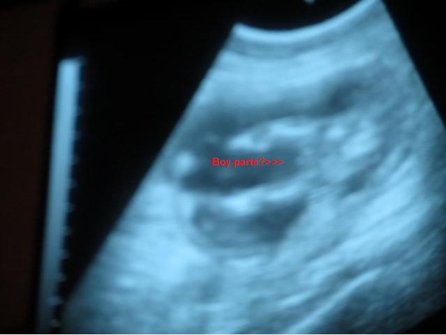 Name:  boy parts.jpg
Views: 1435
Size:  20.5 KB
