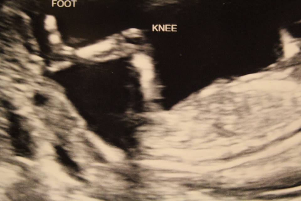 Name:  baby 2.jpg
Views: 121
Size:  50.0 KB