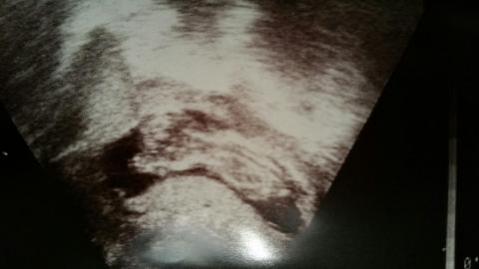 Name:  12w5.jpg
Views: 353
Size:  13.9 KB