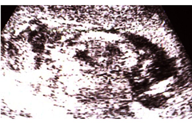 Name:  1111111.jpg
Views: 185
Size:  71.4 KB