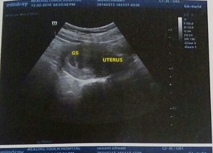 Name:  baby 1st photo.jpg
Views: 743
Size:  41.5 KB