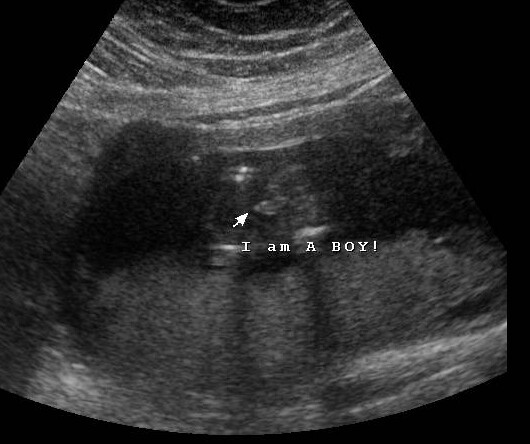Name:  BABY BOTELHO_8~2.jpg
Views: 1755
Size:  50.8 KB