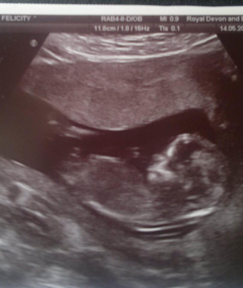 Name:  13 weeks.jpg
Views: 144
Size:  54.0 KB