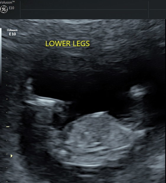 Name:  Baby Pic.jpg
Views: 580
Size:  71.2 KB