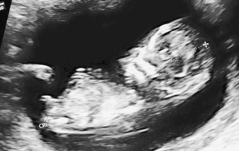 Name:  Baby Pic_updated.jpg
Views: 270
Size:  79.7 KB