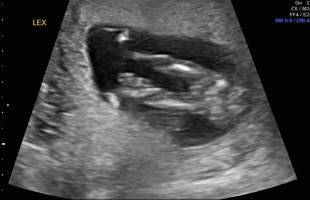 Name:  BabyE_1 copy.jpg
Views: 422
Size:  80.5 KB