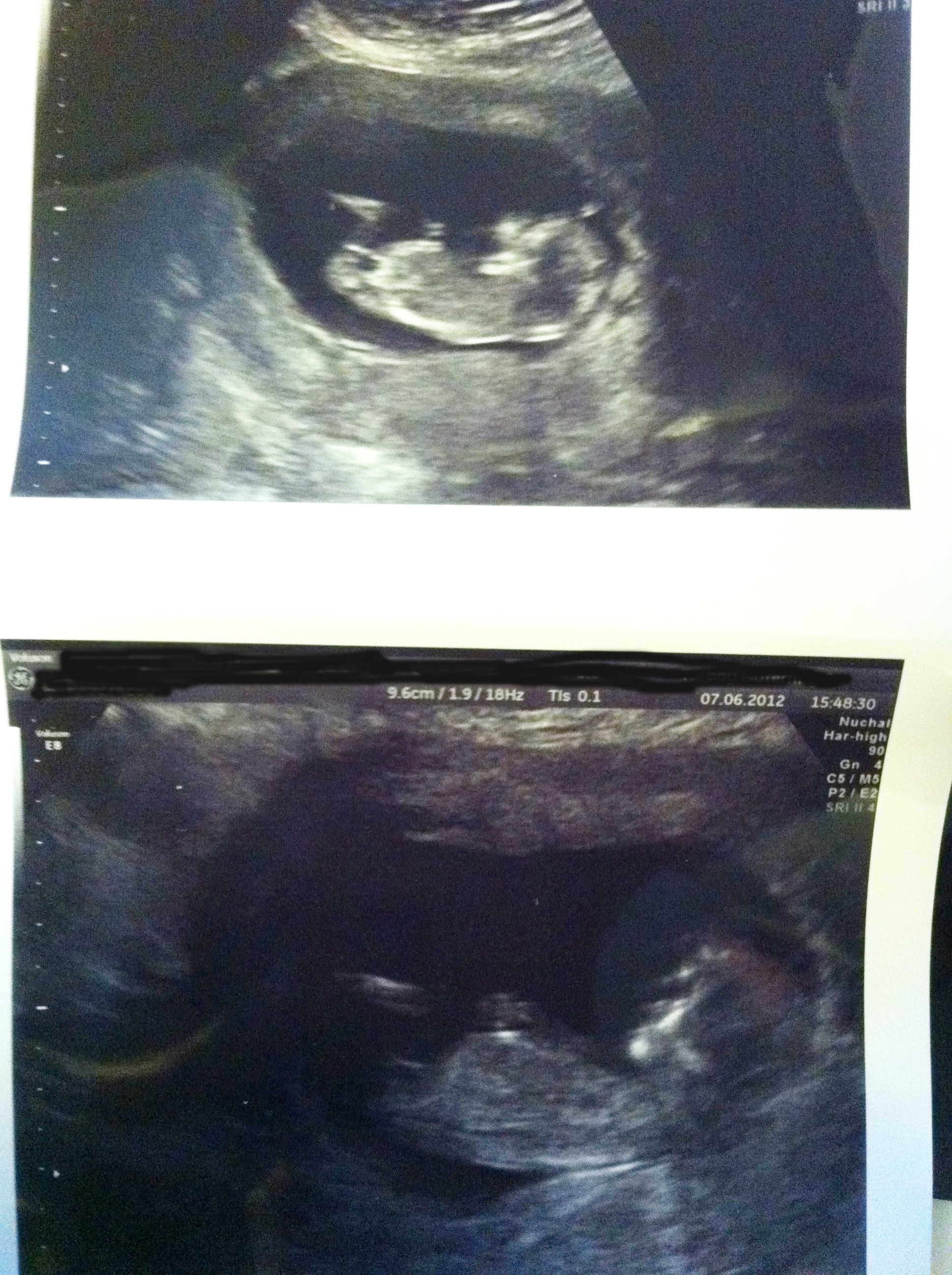 Name:  baby1a1.jpg
Views: 440
Size:  2.28 MB