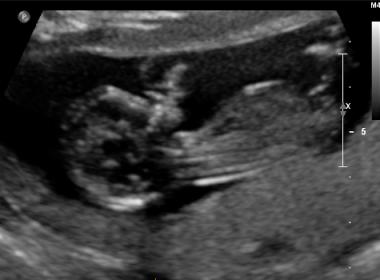 Name:  girl or boy.jpg
Views: 387
Size:  13.8 KB