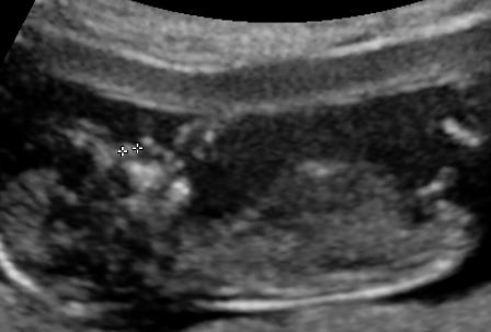 Name:  baby pic4.JPG
Views: 585
Size:  23.9 KB