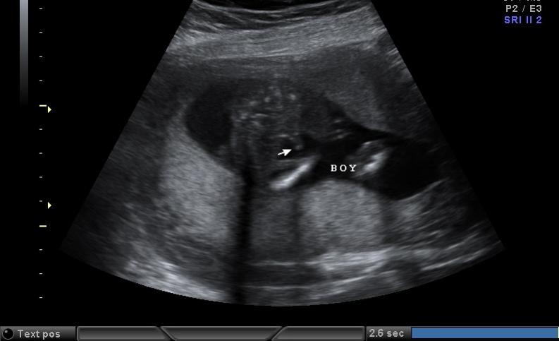 Name:  BABY.jpg
Views: 192
Size:  33.0 KB