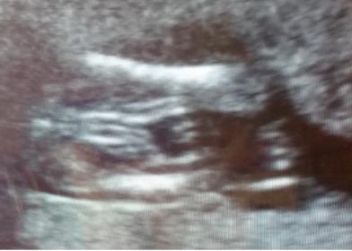 Name:  Ultrasound.jpg
Views: 110
Size:  14.1 KB
