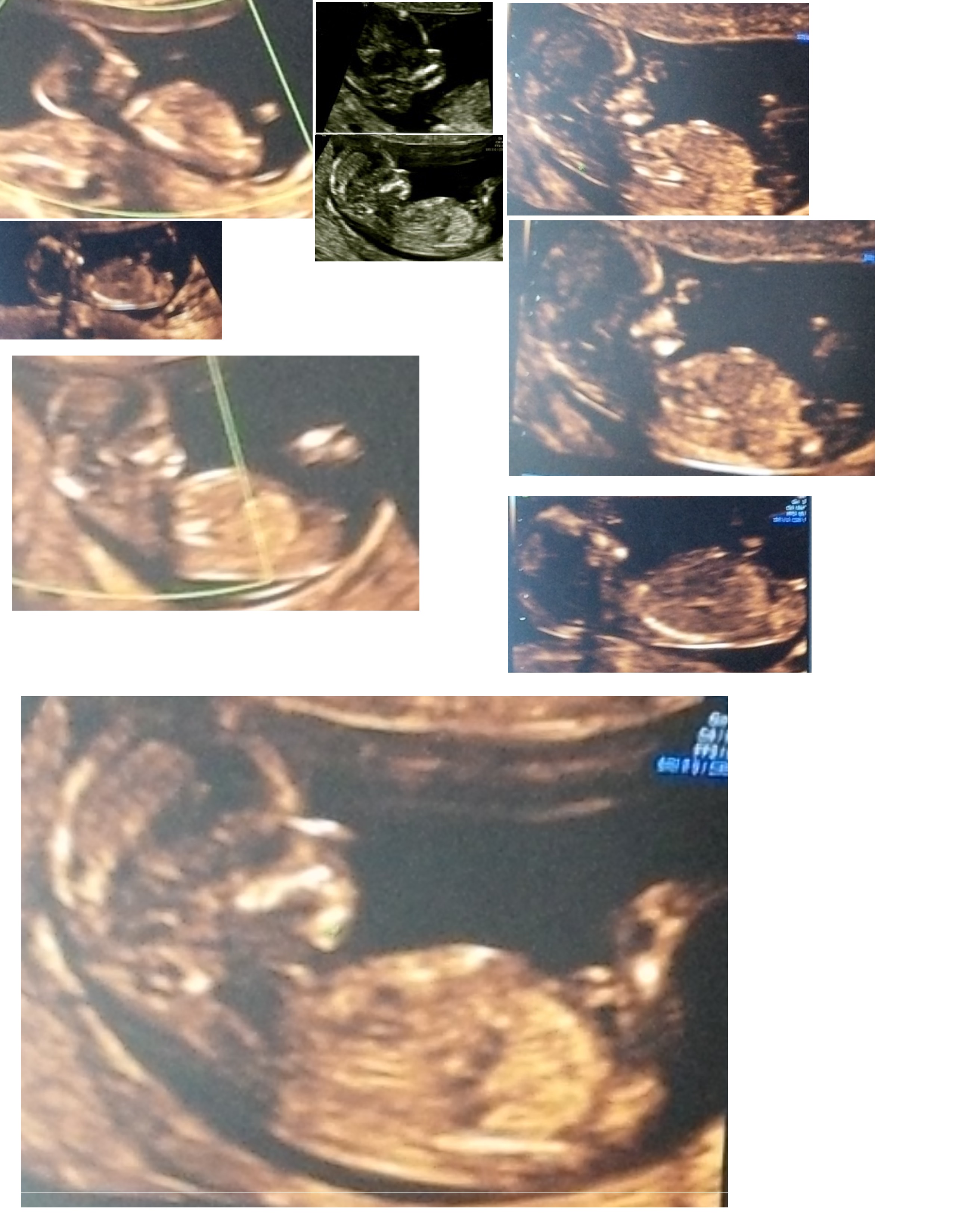 Name:  all scans.jpg
Views: 139
Size:  905.9 KB