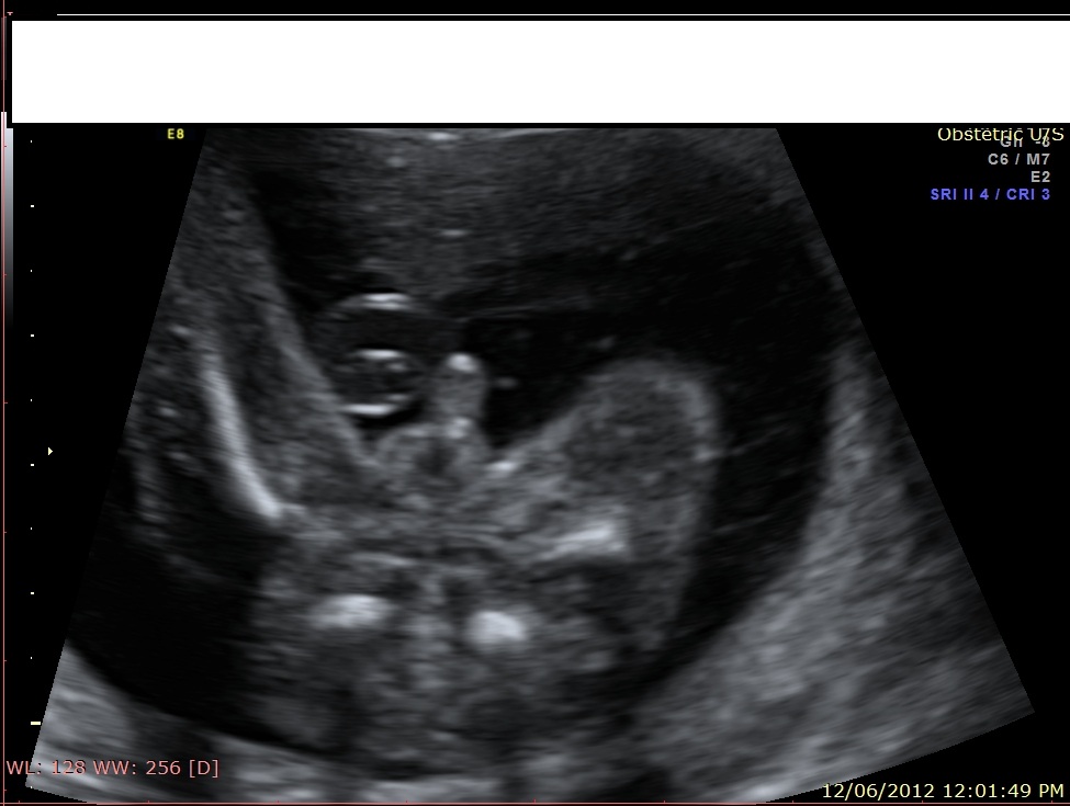 Name:  baby boy.jpg
Views: 172
Size:  110.7 KB