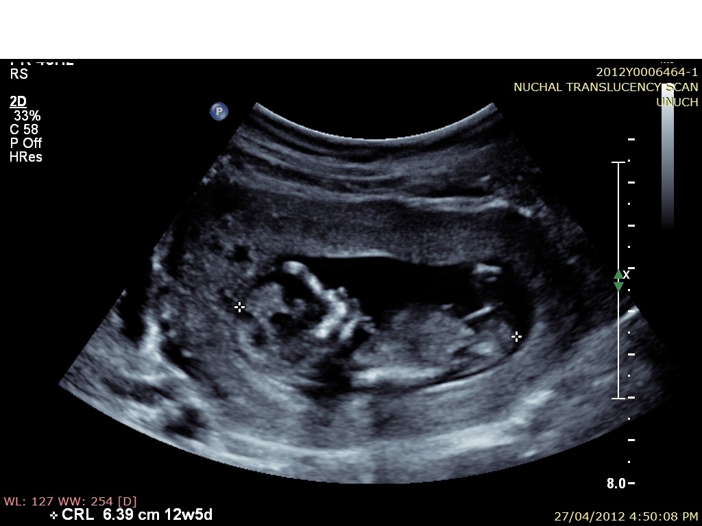 Name:  baby3.jpg
Views: 4098
Size:  136.5 KB