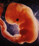 Name:  week9.gif
Views: 9658
Size:  11.6 KB