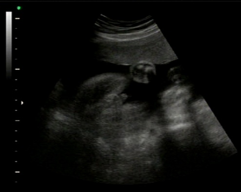 Name:  3.jpg
Views: 177
Size:  27.2 KB