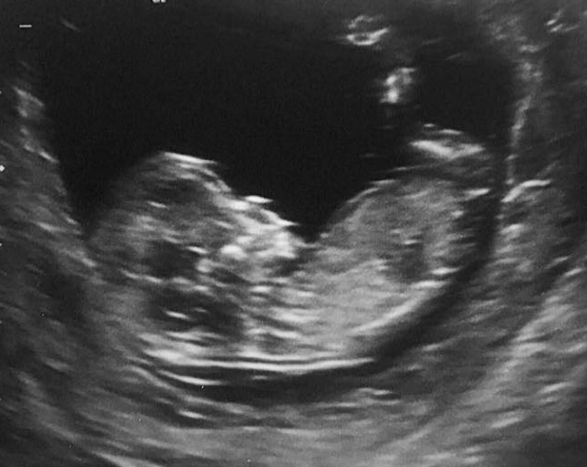 Name:  baby1.jpg
Views: 966
Size:  83.3 KB