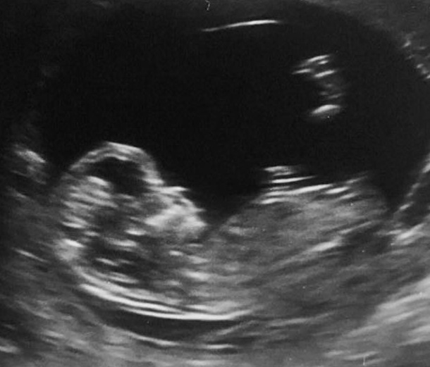 Name:  baby2.jpg
Views: 536
Size:  67.3 KB