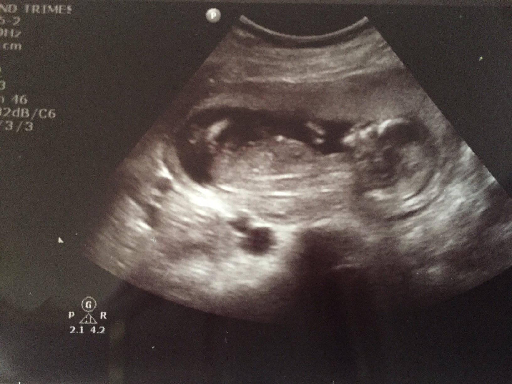 Name:  baby1.jpg
Views: 402
Size:  586.1 KB