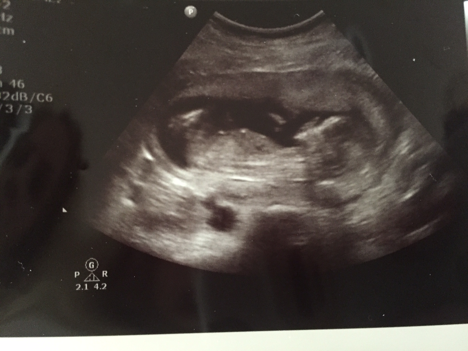 Name:  baby2.jpg
Views: 396
Size:  553.5 KB