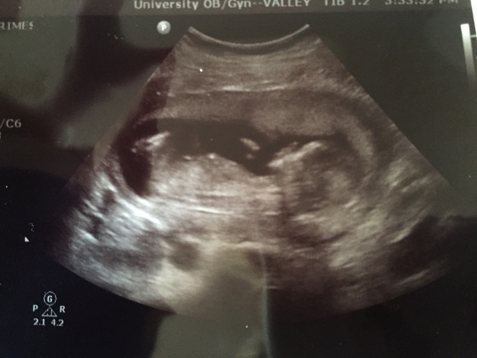 Name:  baby3.JPG
Views: 130
Size:  597.1 KB