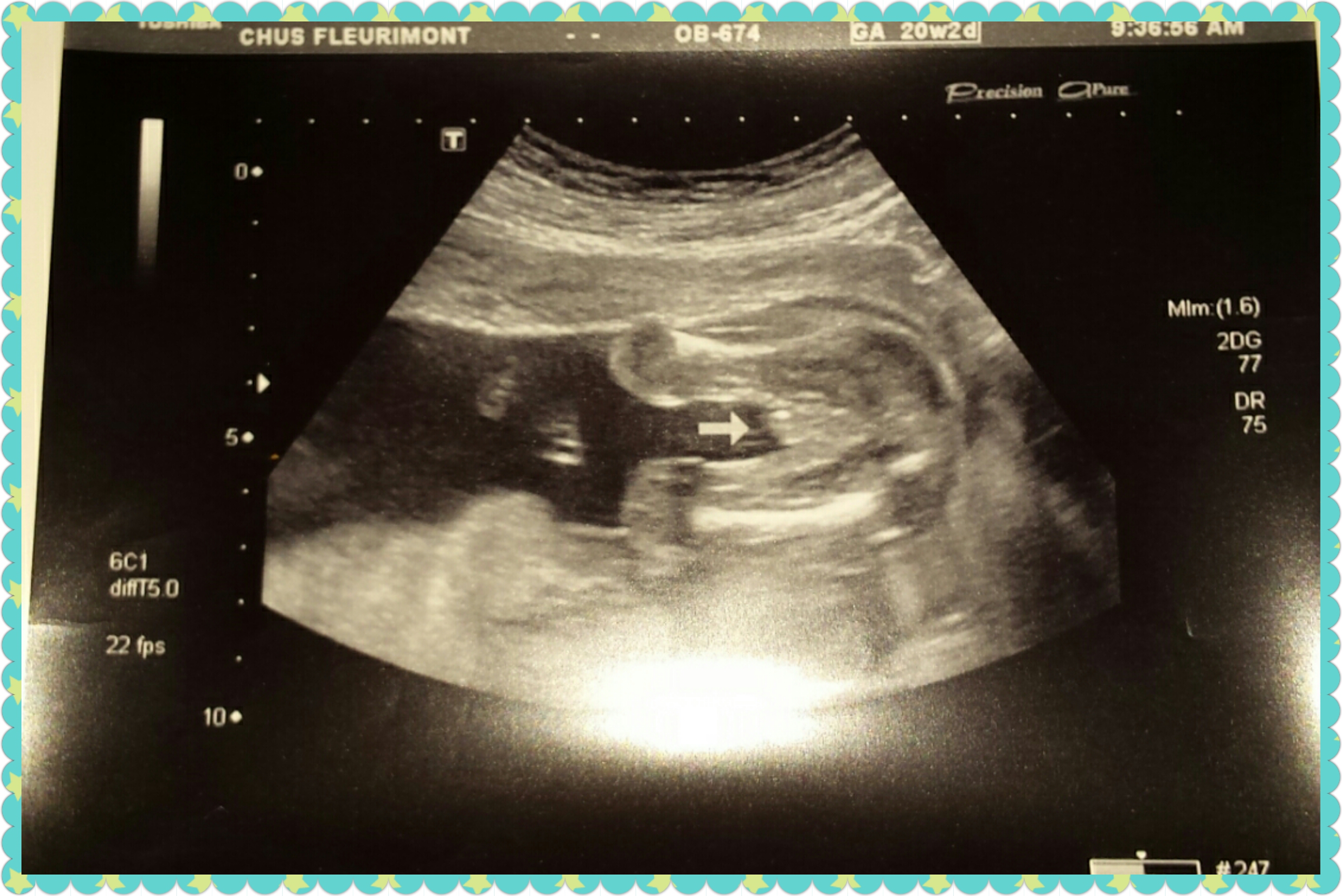 Name:  PhotoGrid_1464104521507.jpg
Views: 980
Size:  2.41 MB