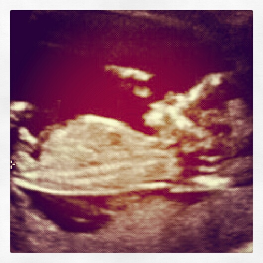 Name:  IMG BABY.jpg
Views: 285
Size:  96.0 KB