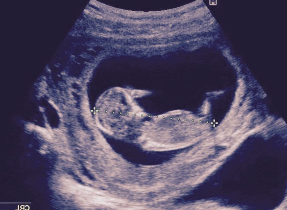 Name:  baby4nub.jpg
Views: 184
Size:  58.4 KB