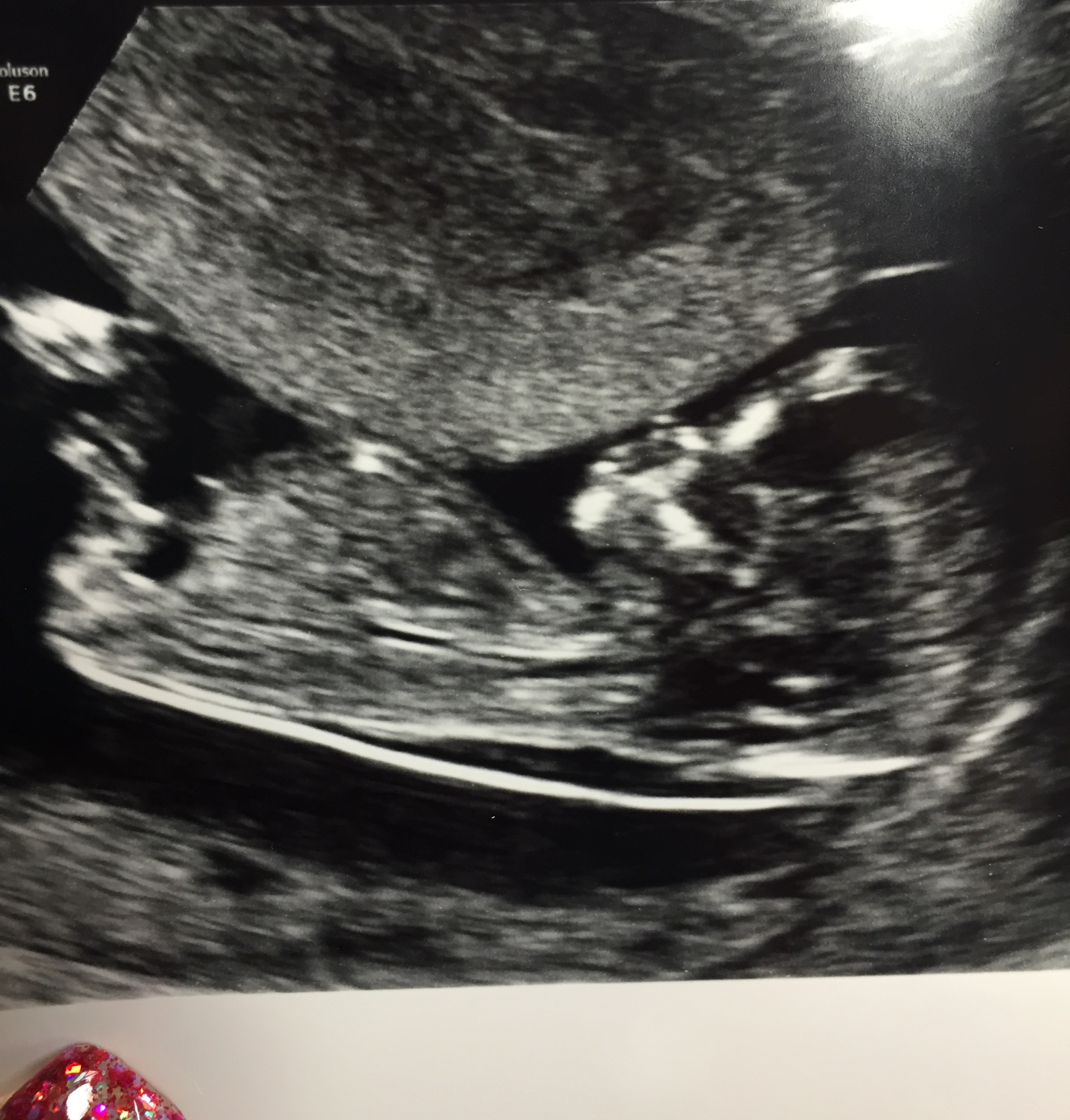 Name:  image.jpeg
Views: 145
Size:  1.05 MB