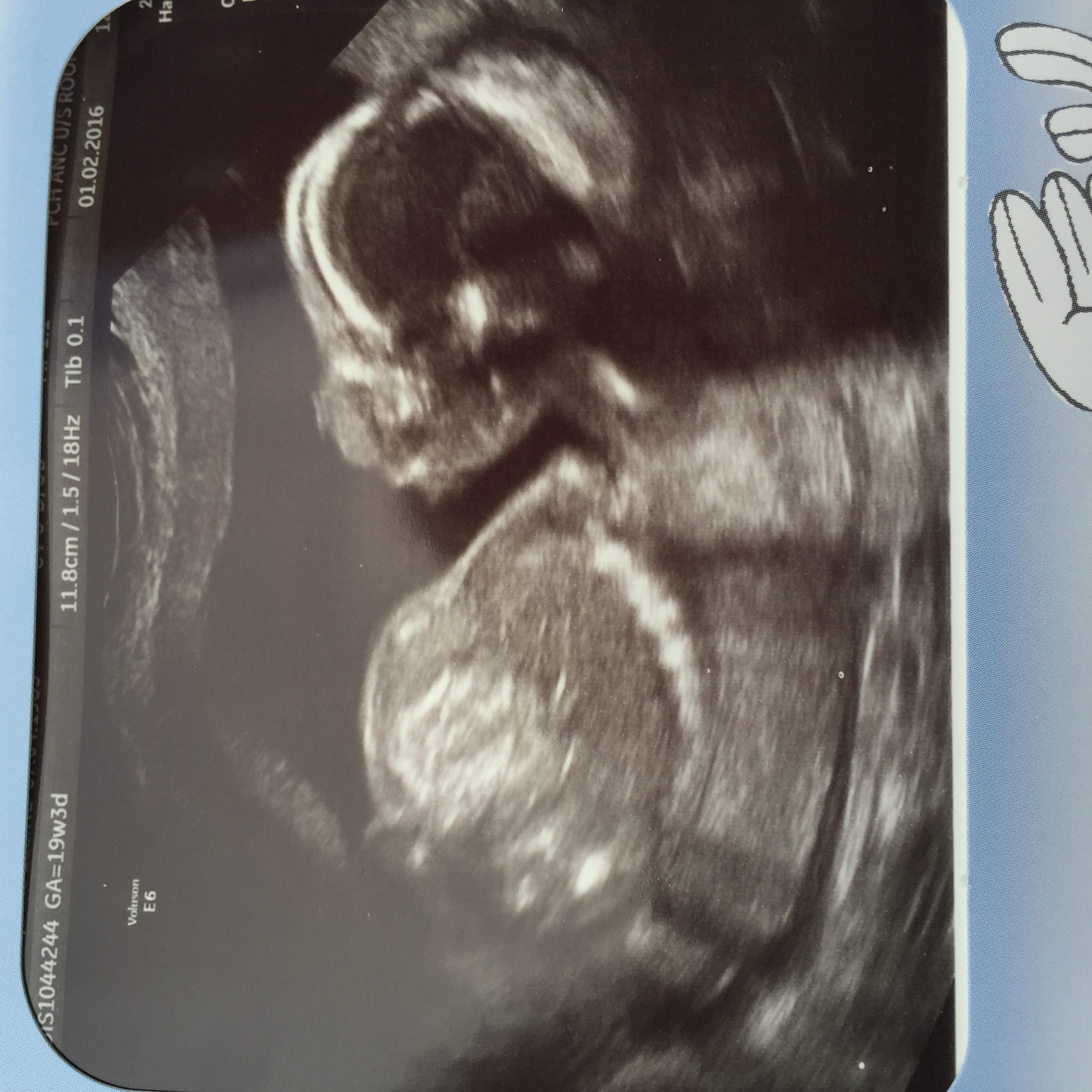 Name:  image.jpeg
Views: 103
Size:  1.51 MB