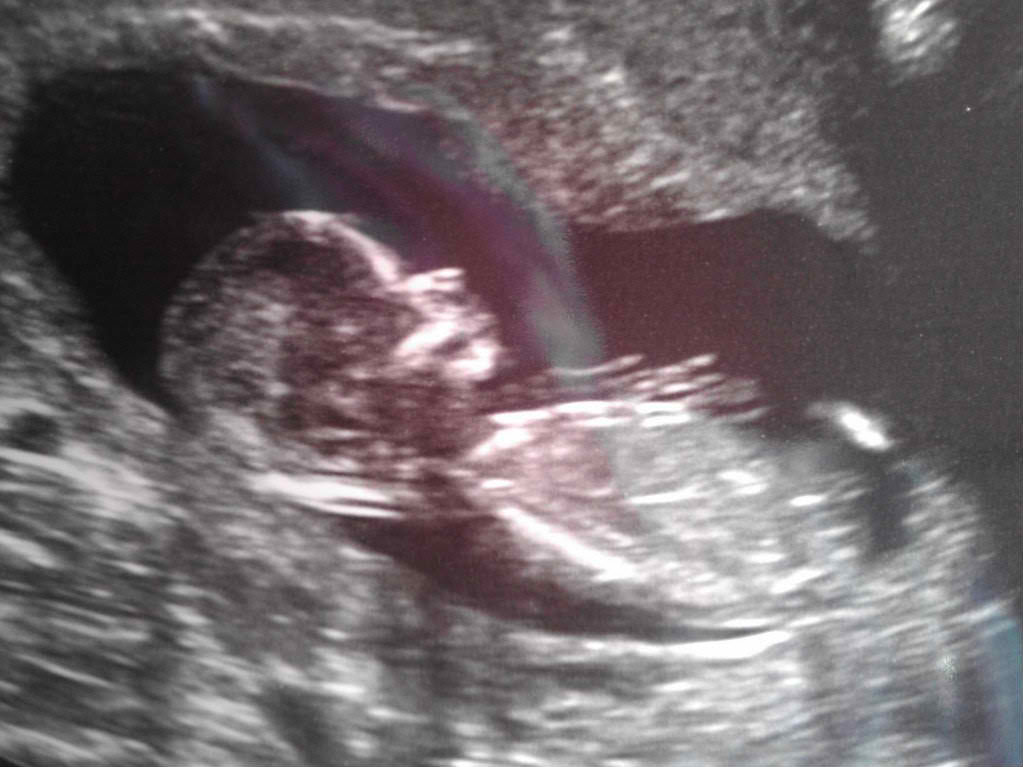 Name:  Baby.jpg
Views: 192
Size:  85.2 KB