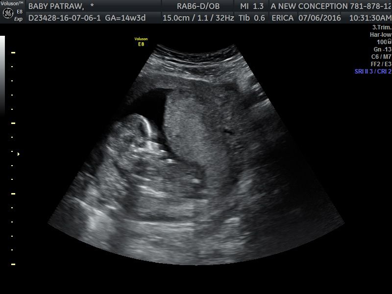 Name:  BABY PATRAW1.jpg
Views: 232
Size:  49.6 KB
