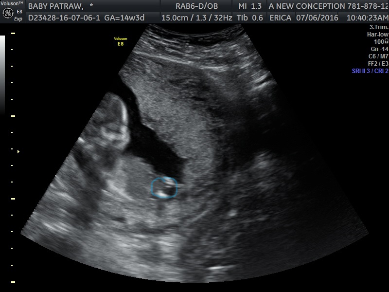 Name:  BABY PATRAWcolor.jpg
Views: 181
Size:  105.1 KB