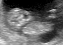 Name:  11weeks 3.jpg
Views: 5458
Size:  32.7 KB