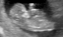 Name:  11weeks 5.jpg
Views: 5130
Size:  29.8 KB
