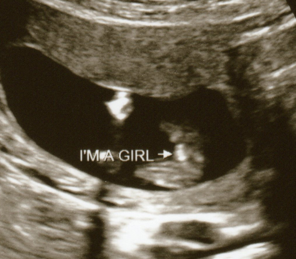 Name:  baby5at15weeks002.jpg
Views: 52715
Size:  281.6 KB
