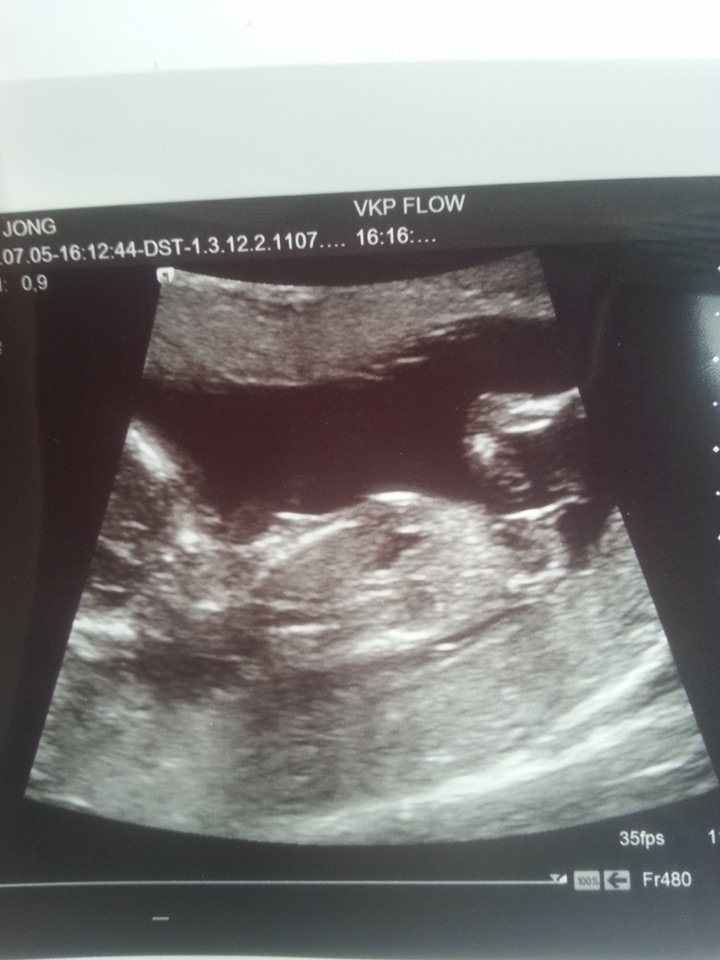 Name:  babynub1.jpg
Views: 352
Size:  90.9 KB