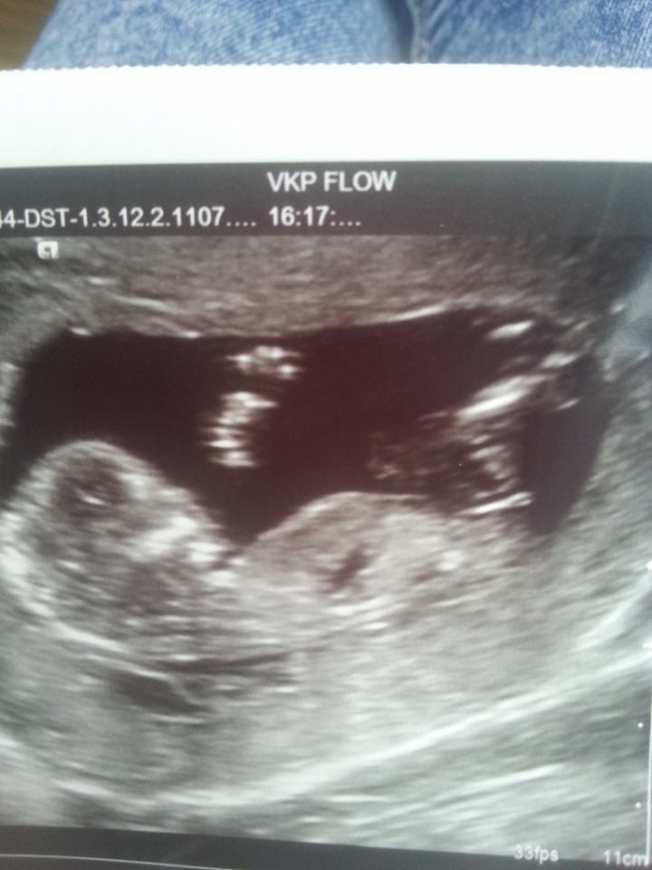 Name:  babynub2.jpg
Views: 401
Size:  96.7 KB