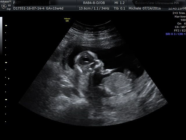 Name:  baby1.jpg
Views: 105
Size:  52.4 KB