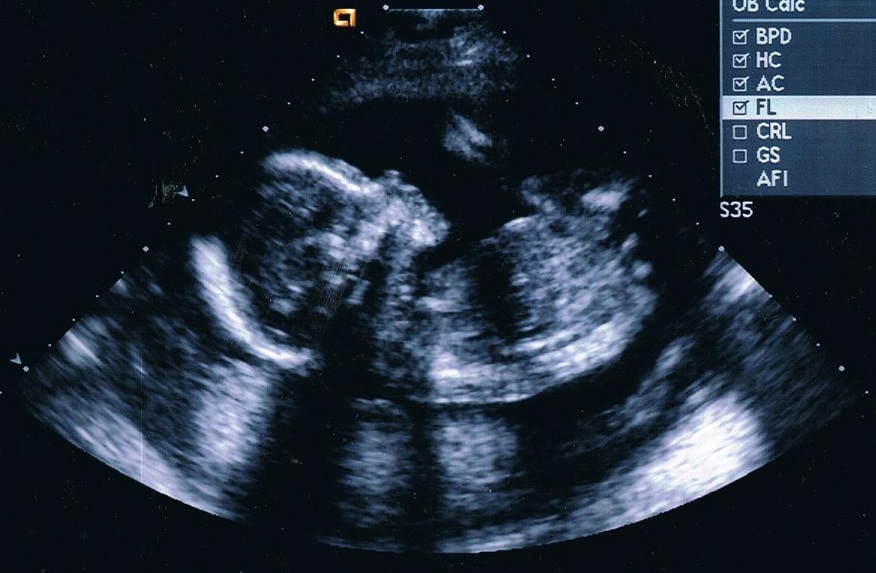 Name:  profile.jpg
Views: 3263
Size:  144.9 KB