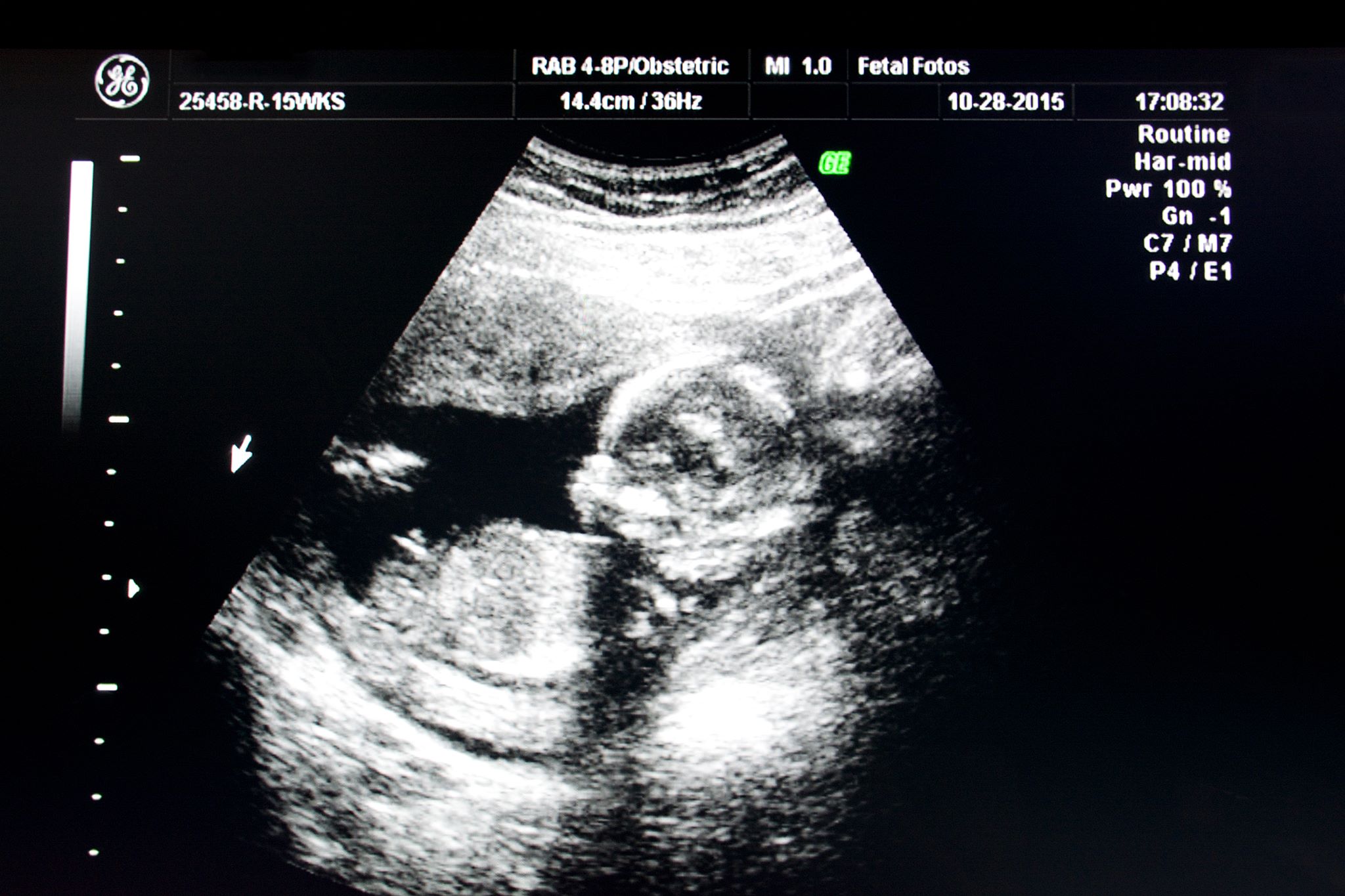 Name:  mybaby4.jpg
Views: 219
Size:  266.5 KB